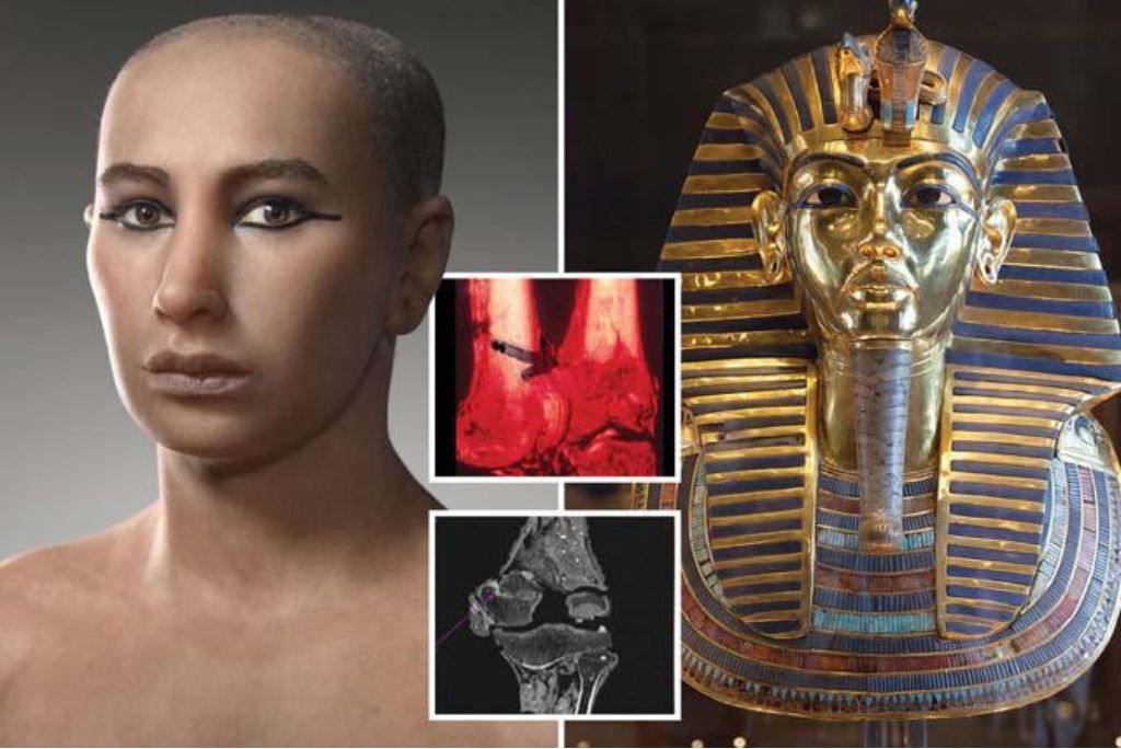 Mysterious Death of King Tutankhamun